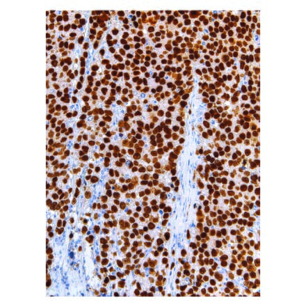 Immunohistochemistry - Anti-Sall4 Antibody [IHC659] (A324493) - Antibodies.com