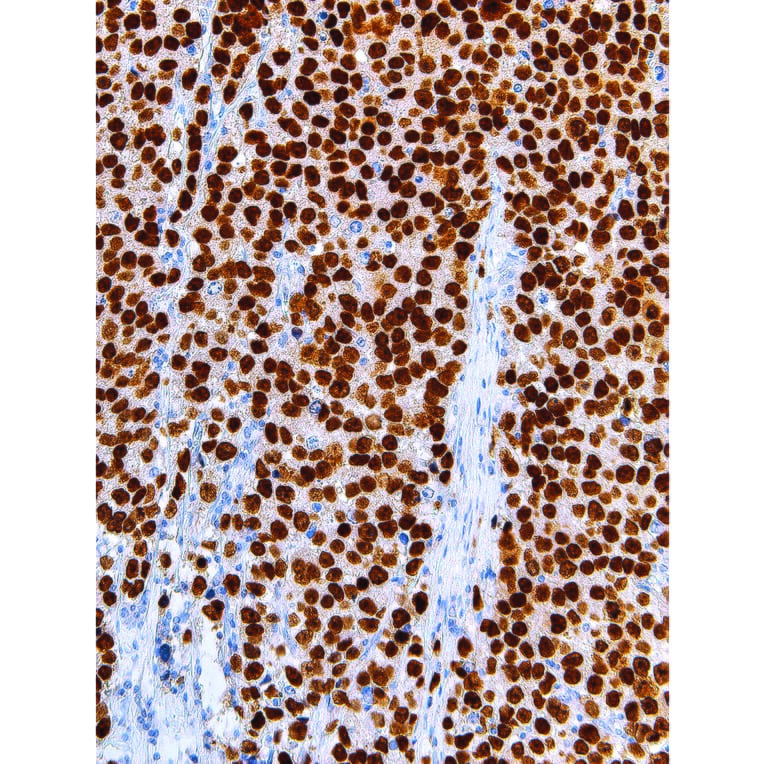 Immunohistochemistry - Anti-Sall4 Antibody [IHC659] (A324493) - Antibodies.com