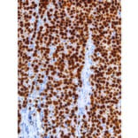 Immunohistochemistry - Anti-Sall4 Antibody [IHC659] (A324493) - Antibodies.com