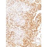 Immunohistochemistry - Anti-SOX11 Antibody [IHC111] (A324494) - Antibodies.com