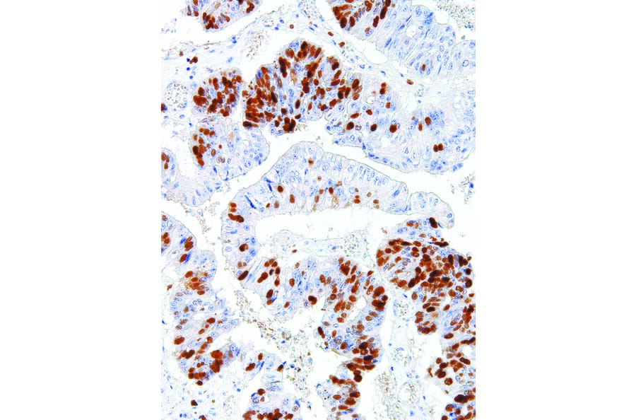 Immunohistochemistry - Anti-Survivin Antibody [IHC668] (A324495) - Antibodies.com