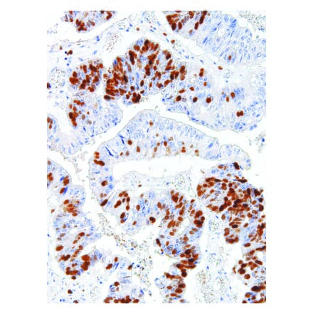 Immunohistochemistry - Anti-Survivin Antibody [IHC668] (A324495) - Antibodies.com