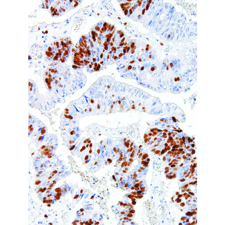 Immunohistochemistry - Anti-Survivin Antibody [IHC668] (A324495) - Antibodies.com