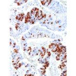 Immunohistochemistry - Anti-Survivin Antibody [IHC668] (A324495) - Antibodies.com