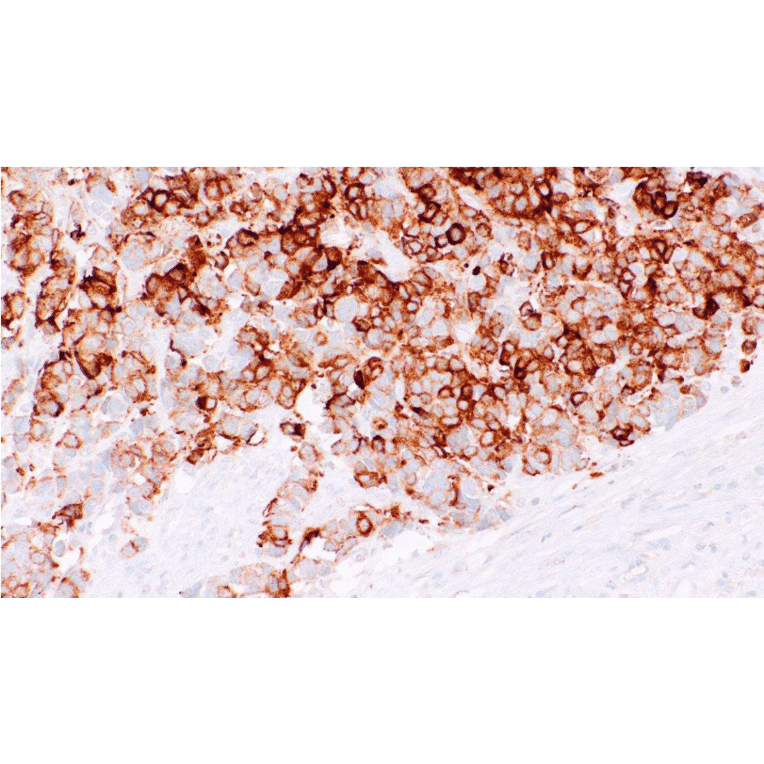 Immunohistochemistry - Anti-Synaptophysin Antibody [IHC669] (A324496) - Antibodies.com