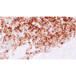 Immunohistochemistry - Anti-Synaptophysin Antibody [IHC669] (A324496) - Antibodies.com