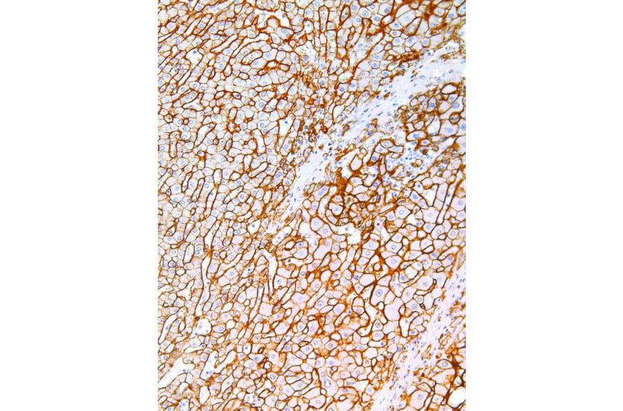 Immunohistochemistry - Anti-Syndecan-1 Antibody [IHC138] (A324497) - Antibodies.com