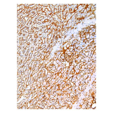 Immunohistochemistry - Anti-Syndecan-1 Antibody [IHC138] (A324497) - Antibodies.com