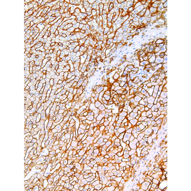 Immunohistochemistry - Anti-Syndecan-1 Antibody [IHC138] (A324497) - Antibodies.com