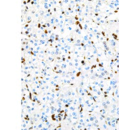 Immunohistochemistry - Anti-TFE3 Antibody [IHC672] (A324498) - Antibodies.com