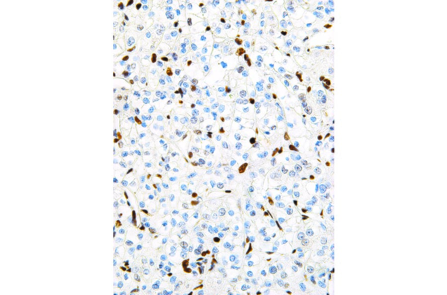 Immunohistochemistry - Anti-TFE3 Antibody [IHC672] (A324498) - Antibodies.com