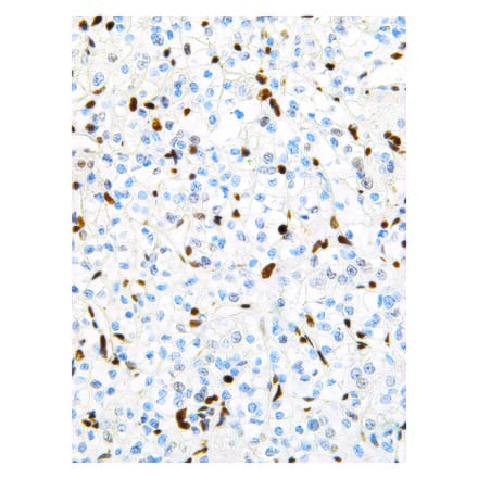 Immunohistochemistry - Anti-TFE3 Antibody [IHC672] (A324498) - Antibodies.com