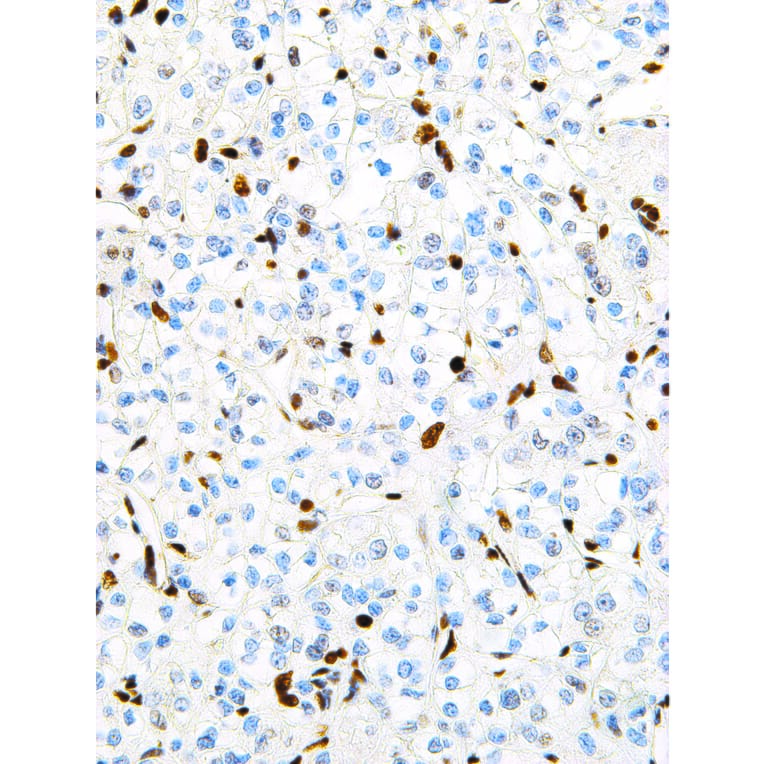 Immunohistochemistry - Anti-TFE3 Antibody [IHC672] (A324498) - Antibodies.com
