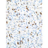 Immunohistochemistry - Anti-TFE3 Antibody [IHC672] (A324498) - Antibodies.com