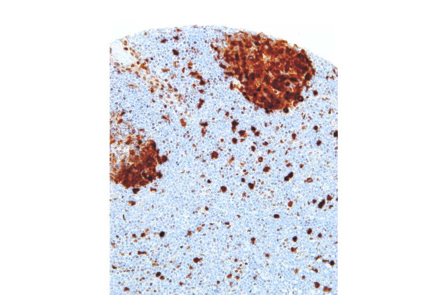 Immunohistochemistry - Anti-Thymidylate Synthase Antibody [IHC697] (A324499) - Antibodies.com