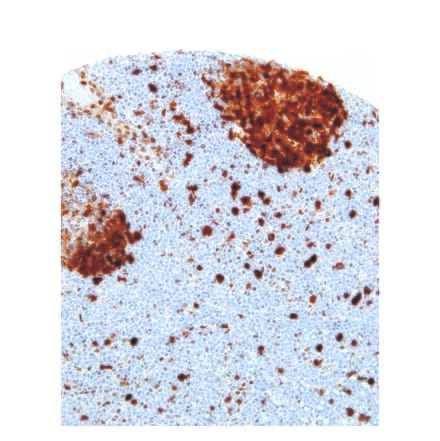 Immunohistochemistry - Anti-Thymidylate Synthase Antibody [IHC697] (A324499) - Antibodies.com