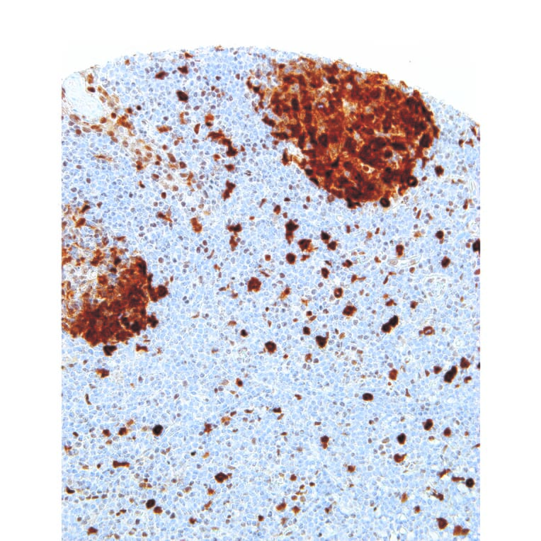 Immunohistochemistry - Anti-Thymidylate Synthase Antibody [IHC697] (A324499) - Antibodies.com