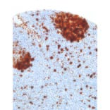 Immunohistochemistry - Anti-Thymidylate Synthase Antibody [IHC697] (A324499) - Antibodies.com