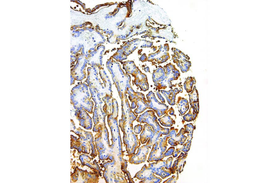 Immunohistochemistry - Anti-Thyroglobulin Antibody [IHC674] (A324500) - Antibodies.com