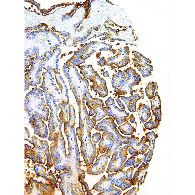 Immunohistochemistry - Anti-Thyroglobulin Antibody [IHC674] (A324500) - Antibodies.com