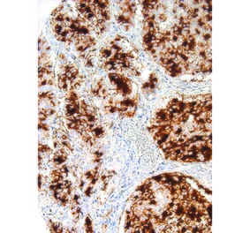 Immunohistochemistry - Anti-Tissue Factor Antibody [IHC517] (A324501) - Antibodies.com