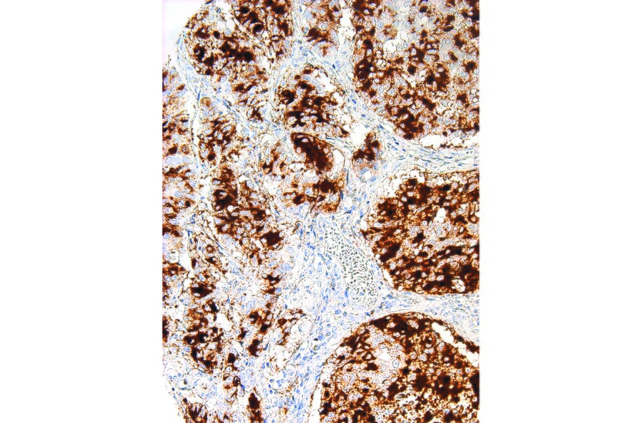 Immunohistochemistry - Anti-Tissue Factor Antibody [IHC517] (A324501) - Antibodies.com