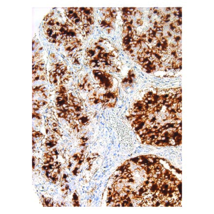 Immunohistochemistry - Anti-Tissue Factor Antibody [IHC517] (A324501) - Antibodies.com