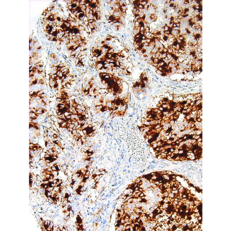 Immunohistochemistry - Anti-Tissue Factor Antibody [IHC517] (A324501) - Antibodies.com