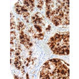 Immunohistochemistry - Anti-Tissue Factor Antibody [IHC517] (A324501) - Antibodies.com