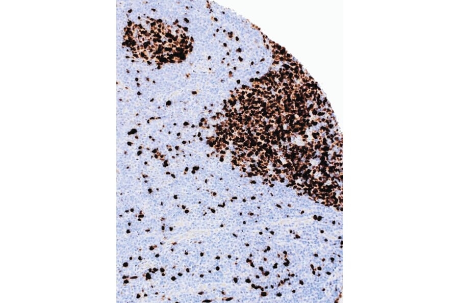 Immunohistochemistry - Anti-Topoisomerase II alpha Antibody [IHC432] (A324502) - Antibodies.com