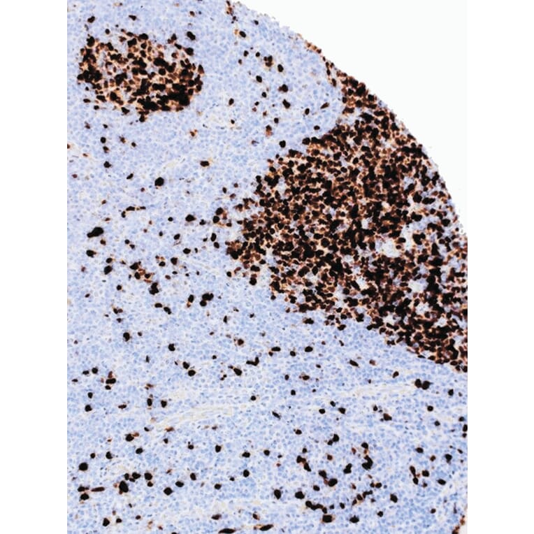 Immunohistochemistry - Anti-Topoisomerase II alpha Antibody [IHC432] (A324502) - Antibodies.com