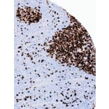 Immunohistochemistry - Anti-Topoisomerase II alpha Antibody [IHC432] (A324502) - Antibodies.com