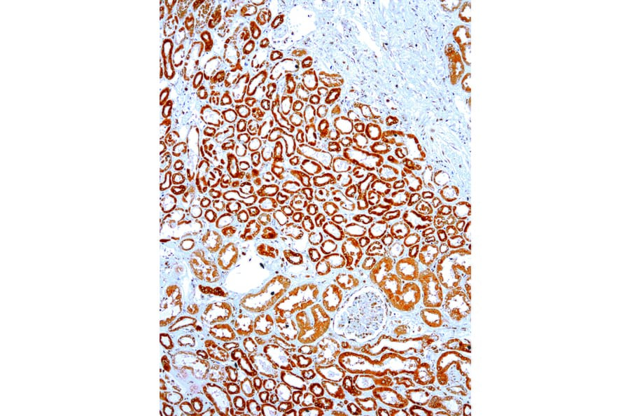 Immunohistochemistry - Anti-VEGFA Antibody [IHC682] (A324504) - Antibodies.com