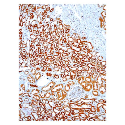 Immunohistochemistry - Anti-VEGFA Antibody [IHC682] (A324504) - Antibodies.com