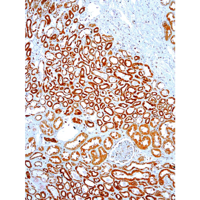 Immunohistochemistry - Anti-VEGFA Antibody [IHC682] (A324504) - Antibodies.com