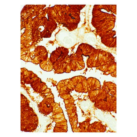 Immunohistochemistry - Anti-Villin Antibody [IHC708] (A324505) - Antibodies.com