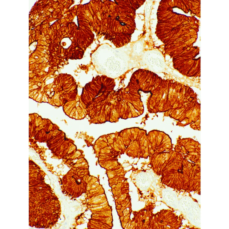 Immunohistochemistry - Anti-Villin Antibody [IHC708] (A324505) - Antibodies.com