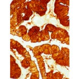 Immunohistochemistry - Anti-Villin Antibody [IHC708] (A324505) - Antibodies.com