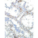 Immunohistochemistry - Anti-Wilms Tumor Protein Antibody [IHC685] (A324507) - Antibodies.com