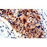 Immunohistochemistry - Anti-BCA-225 Antibody [IHC225] (A324508) - Antibodies.com