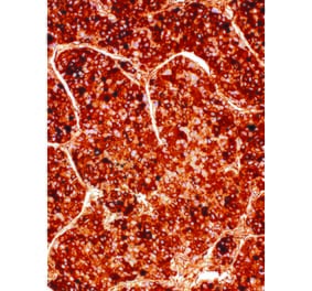 Immunohistochemistry - Anti-alpha 1 Fetoprotein Antibody [IHC714] (A324509) - Antibodies.com