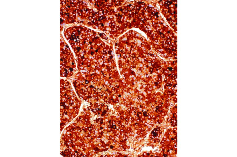 Immunohistochemistry - Anti-alpha 1 Fetoprotein Antibody [IHC714] (A324509) - Antibodies.com