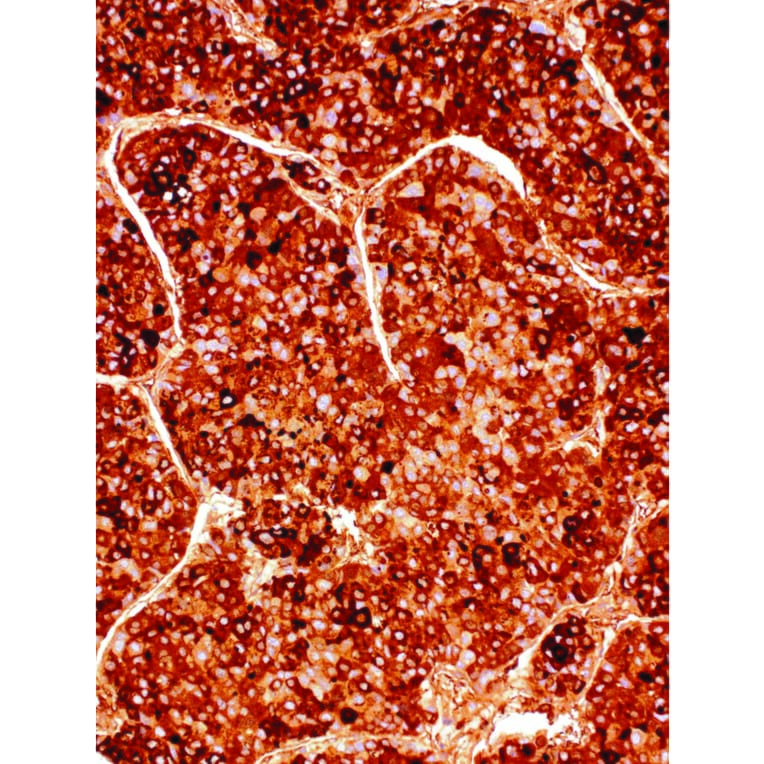 Immunohistochemistry - Anti-alpha 1 Fetoprotein Antibody [IHC714] (A324509) - Antibodies.com