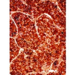 Immunohistochemistry - Anti-alpha 1 Fetoprotein Antibody [IHC714] (A324509) - Antibodies.com