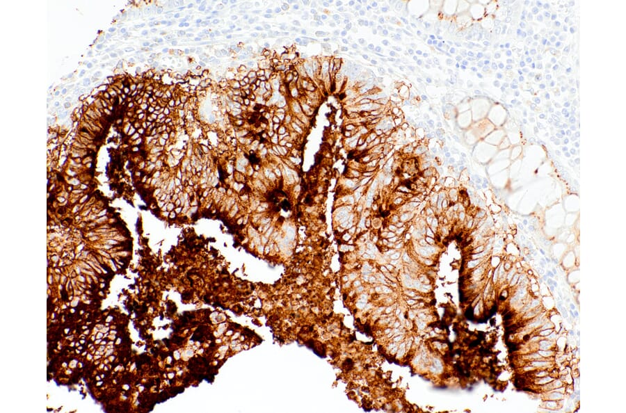 Immunohistochemistry - Anti-CA19-9 Antibody [IHC065] (A324510) - Antibodies.com
