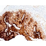 Immunohistochemistry - Anti-CA19-9 Antibody [IHC065] (A324510) - Antibodies.com