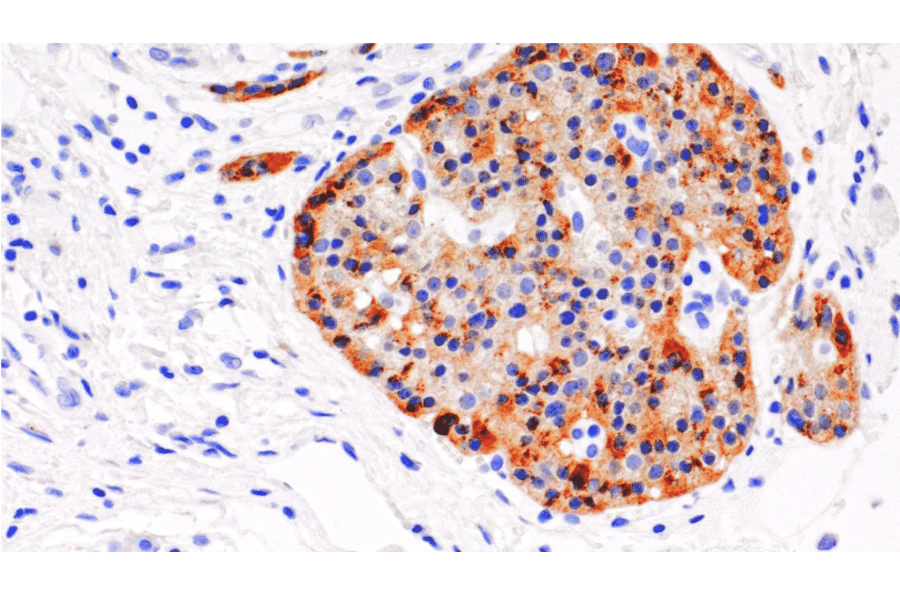 Immunohistochemistry - Anti-Chromogranin B Antibody [IHC497] (A324511) - Antibodies.com
