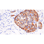 Immunohistochemistry - Anti-Chromogranin B Antibody [IHC497] (A324511) - Antibodies.com