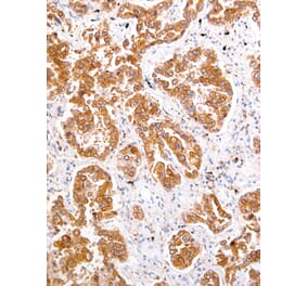 Immunohistochemistry - Anti-ROS1 Antibody [IHC094] (A324513) - Antibodies.com