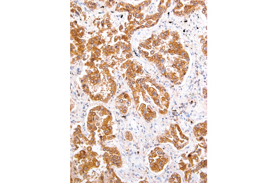 Immunohistochemistry - Anti-ROS1 Antibody [IHC094] (A324513) - Antibodies.com